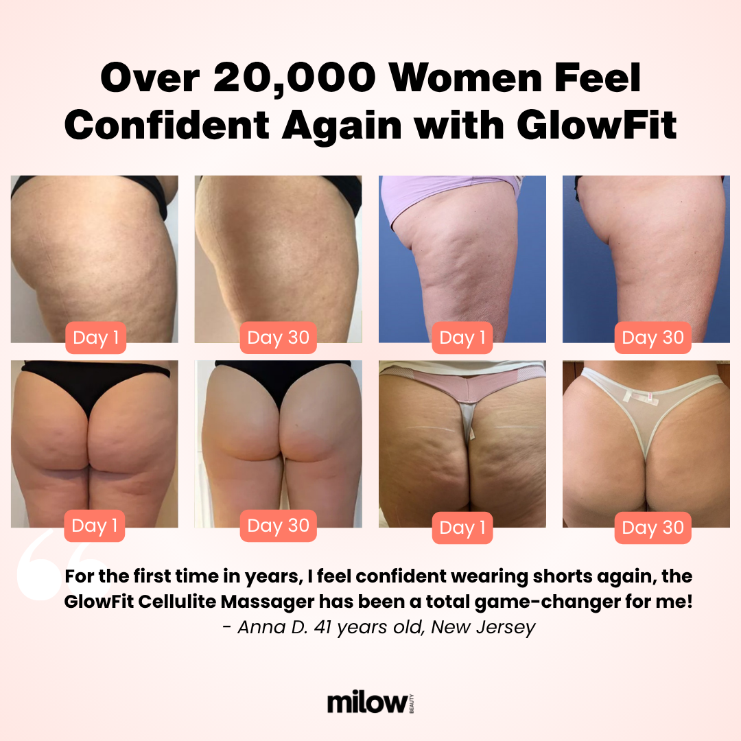 GlowFit 2.0 Cellulite Massager
